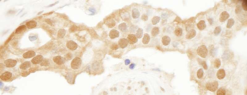 PARK7 / DJ-1 Antibody (aa140-C-term)