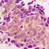ALDOB Antibody (Internal)