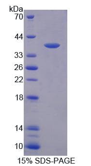 Human PEX19 Protein (Recombinant His, N-Terminal)