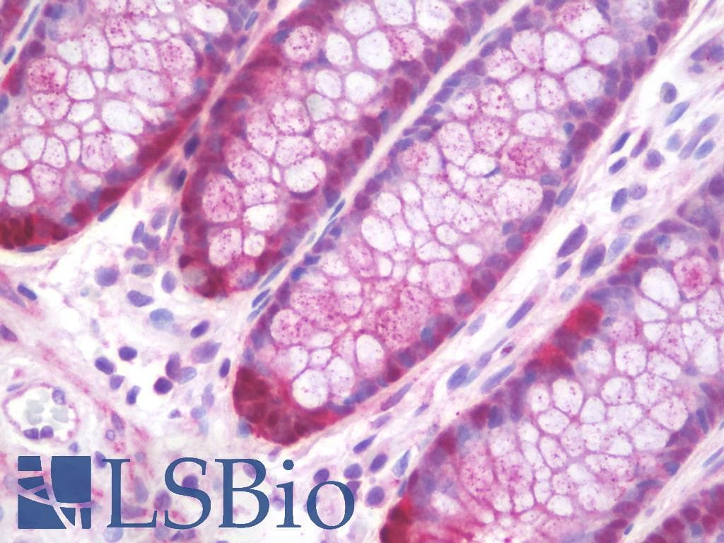 PathPlus™ Polyclonal Rabbit anti-Human TIAM1 Antibody (aa1478-1506, IHC, WB)