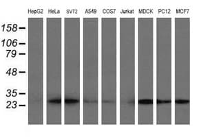Monoclonal Mouse anti-Human VBP1 Antibody (clone OTI2C2, IHC, WB)