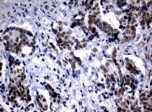 Monoclonal Mouse anti-Human NBN / Nibrin Antibody (clone UMAB99, Carrier-free, aa461-754, IHC, IF, WB)