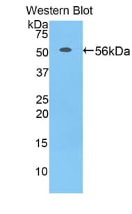 PHAP1 / ANP32A Antibody (aa2-247)