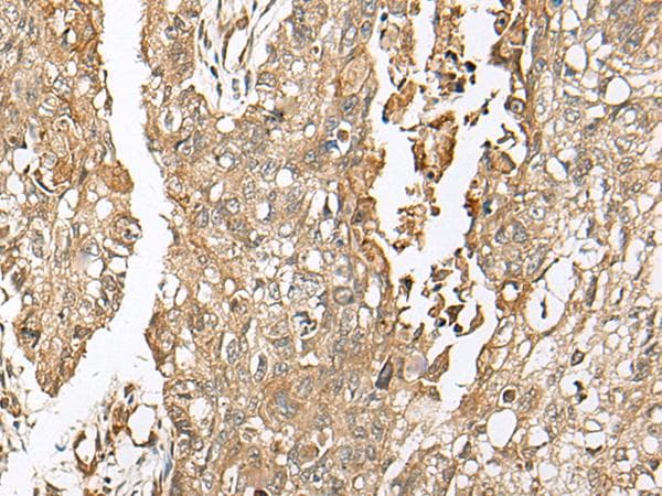 COA7 / SELRC1 Antibody