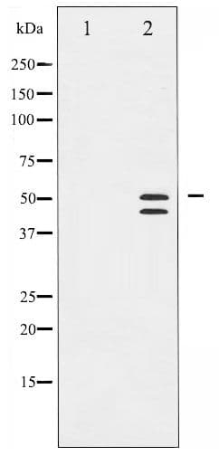 VASP Antibody (phospho-Ser238)