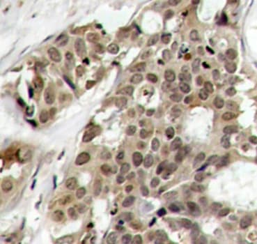 Polyclonal Rabbit anti-Human MAPK3 / ERK1 Antibody (phospho-Tyr204, IHC, IF, WB)