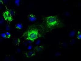 GAD1 / GAD67 Antibody (clone OTI3H2)