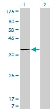 IHC-plus™ Monoclonal Mouse anti-Human MDM2 Antibody (clone 1A7, IHC, WB)