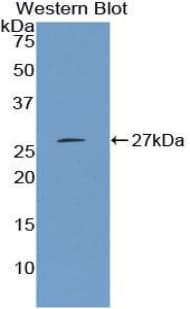 CTH / Cystathionase Antibody (aa14-224, FITC)