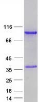 Human ZNF579 Protein (Recombinant Myc-DDK (Flag))