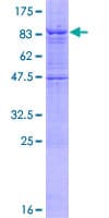 Human IPPK Protein (Recombinant GST)