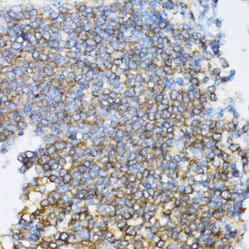UBE2D1 / UBCH5 Antibody