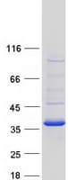 Human CBR3 Protein (Recombinant Myc-DDK (Flag))