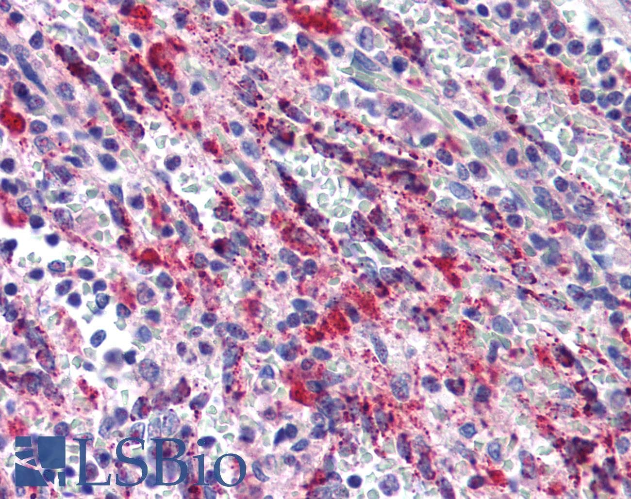 PathPlus™ Polyclonal Rabbit anti-Human TGFB1 / TGF Beta 1 Antibody (IHC, IF, WB)