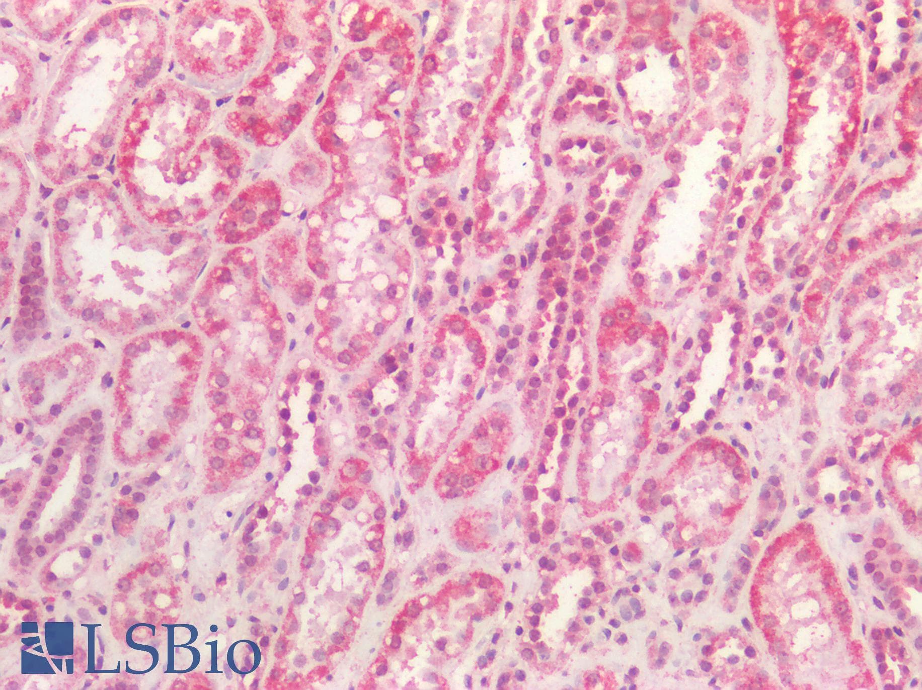 PathPlus™ Polyclonal Goat anti-Human SDHB Antibody (aa271-280, IHC, WB)