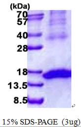 Human KLRK1 / CD314 / NKG2D Protein (Recombinant His)