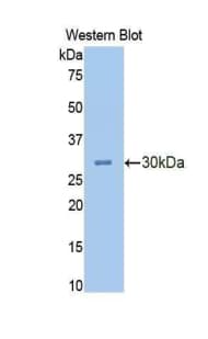 CEA / Carcinoembryonic Antigen Antibody (aa544-771, APC)