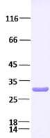 Human OSM / Oncostatin M Protein (Recombinant)