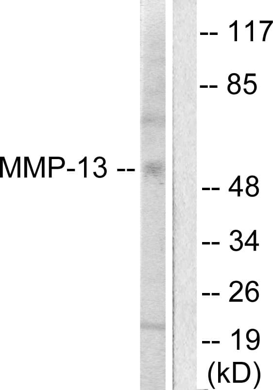 Polyclonal Rabbit anti-Human MMP13 Antibody (aa10-59, IHC, IF, WB)
