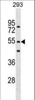 FBXW9 Antibody (aa5-31)