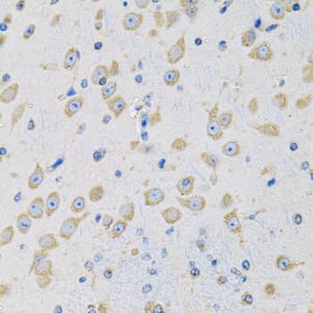 Polyclonal Rabbit anti-Human MSRA Antibody (IHC, IF, WB)