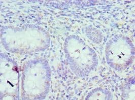 Polyclonal Rabbit anti-Human ICSBP / IRF8 Antibody (aa137-426, IHC)