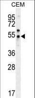 Polyclonal Rabbit anti-Human FOLH1B Antibody (aa395-423, WB)
