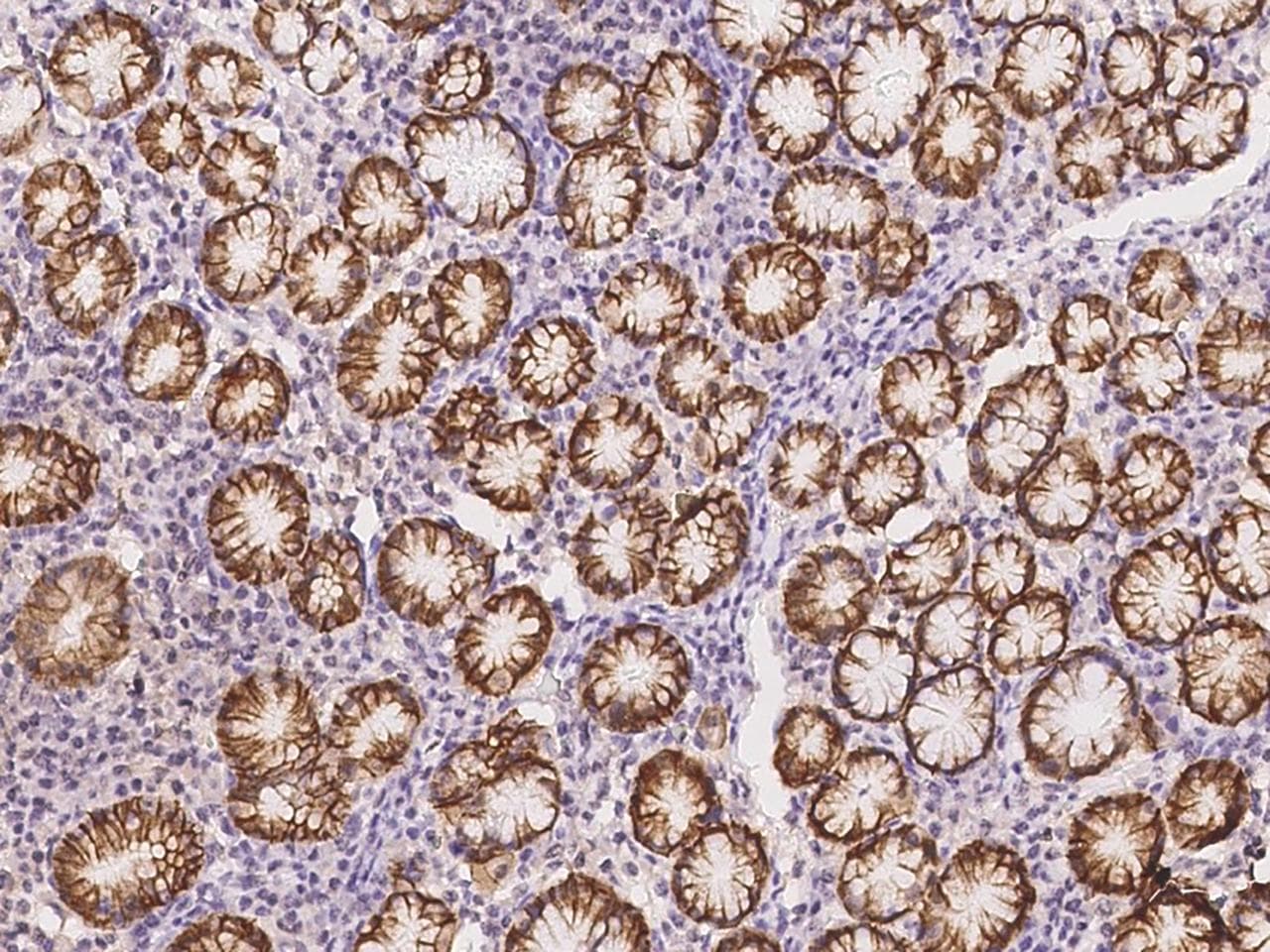 ABCC3 / MRP3 Antibody
