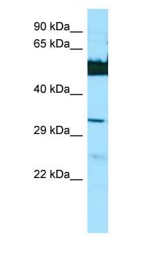 Polyclonal Rabbit anti-Human LGSN Antibody (N-Terminus, WB)