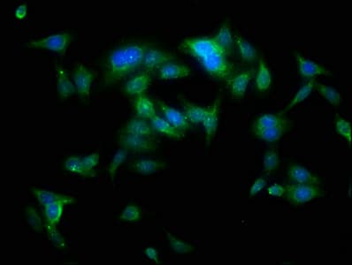 IHC-plus™ Polyclonal Rabbit anti-Human YARS / Tyrosyl-tRNA Synthetase Antibody (IHC, WB)