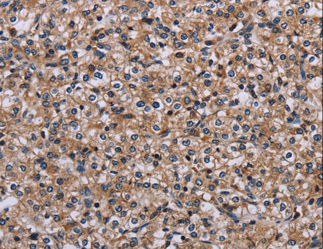 IPO4 Antibody
