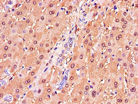 GSTA1 Antibody