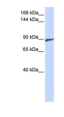 Polyclonal Rabbit anti-Human SPATA5 Antibody (C-Terminus, WB)