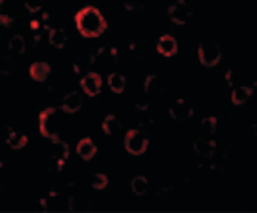 IHC-plus™ Polyclonal Rabbit anti-Human DENN / MADD Antibody (IHC, IF, WB)