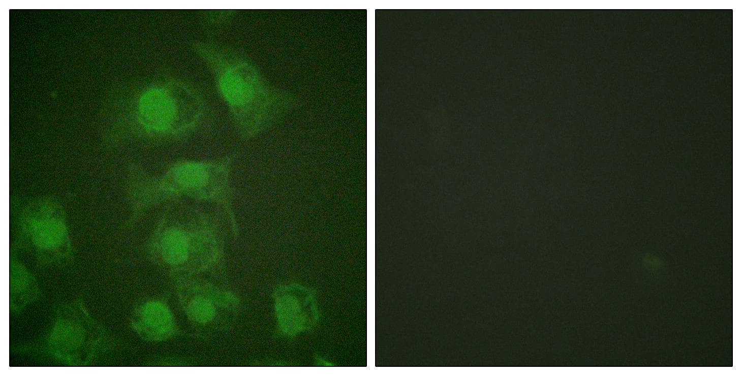 FOSB Antibody (phospho-Ser27)