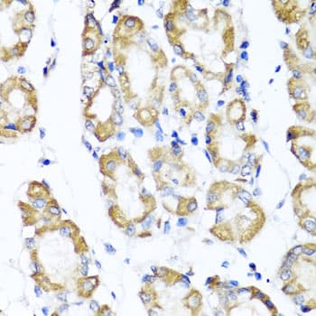 Polyclonal Rabbit anti-Human ST6GAL1 / CD75 Antibody (IHC, WB)