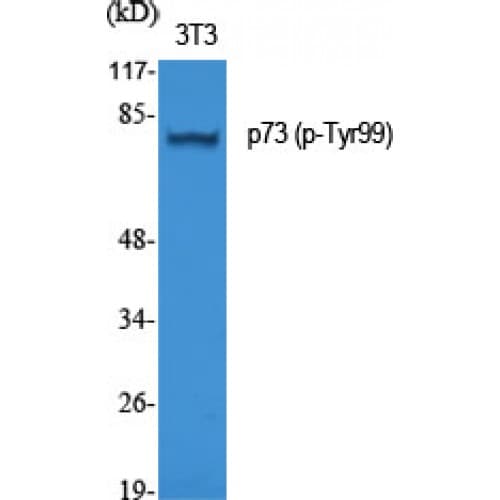 Polyclonal Rabbit anti-Human TP73 / p73 Antibody (40-120 aa, IHC, WB)