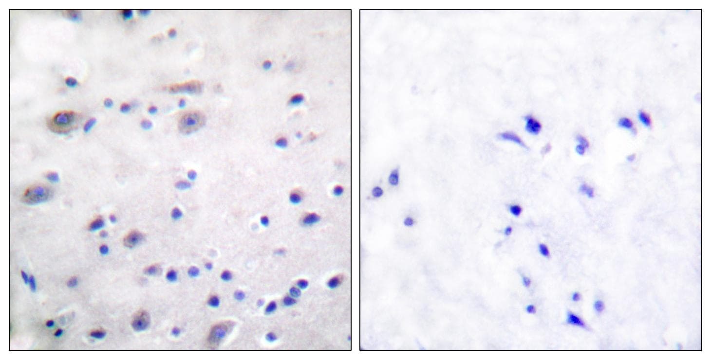 OPRM1 / Mu Opioid Receptor Antibody (phospho-Ser375)