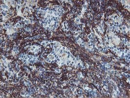 VCAM1 / CD106 Antibody (clone OTI3G7, Carrier-free)