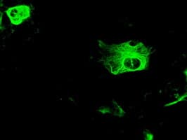 Monoclonal Mouse anti-Human GFAP Antibody (clone OTI4G8, IHC, IF, WB)