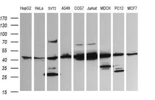 MAP2K1 / MKK1 / MEK1 Antibody (clone OTI2F1)