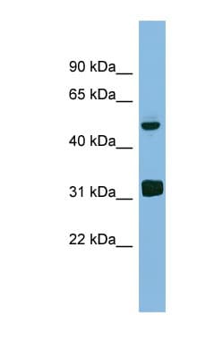 Polyclonal Rabbit anti-Human LYAR Antibody (aa179-228, WB)