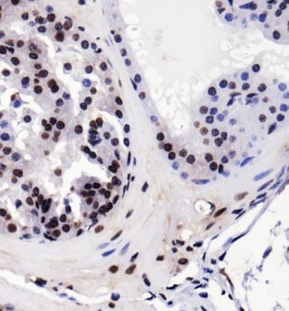 IGF1R / IGF1 Receptor Antibody (DY488)