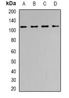 Polyclonal Rabbit anti-Human SMARCA5 / SNF2H Antibody (IF, WB)