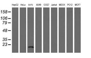 TSC22D1 / TSC22 Antibody (clone OTI3B7)