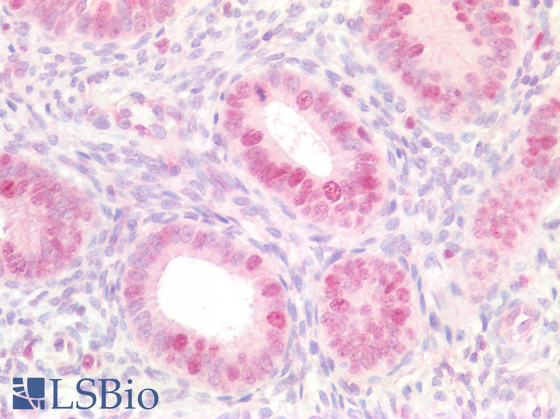 PathPlus™ MCM5 Antibody