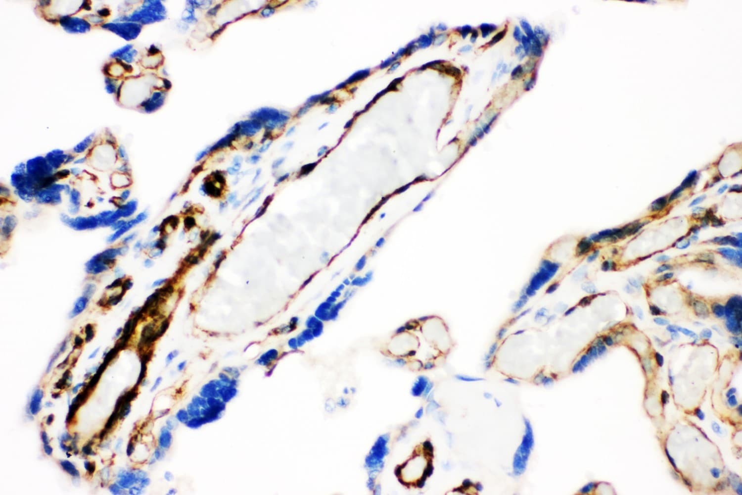 Polyclonal Rabbit anti-Human CAV1 / Caveolin 1 Antibody (aa4-178, IHC, WB)