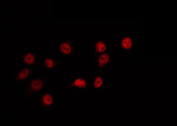 ZIC / ZIC1 Antibody