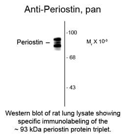 IHC-plus™ POSTN / Periostin Antibody