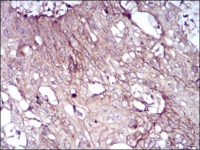 Monoclonal Mouse anti-Human CD6 Antibody (clone 6B11G6, IHC, WB)